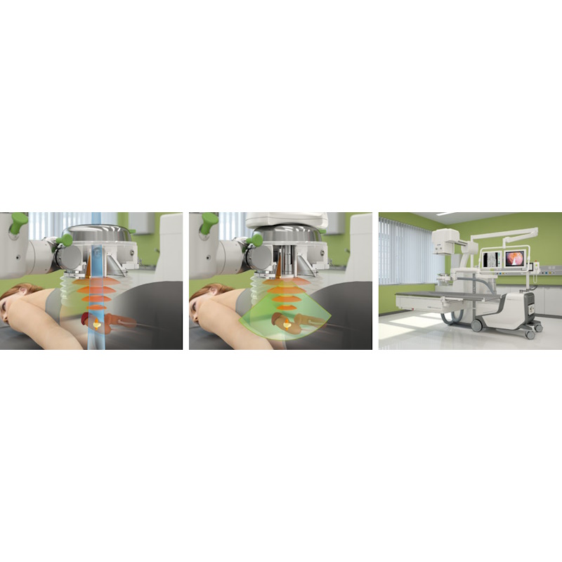 Литотриптер Storz Medical MODULITH SLK intelect